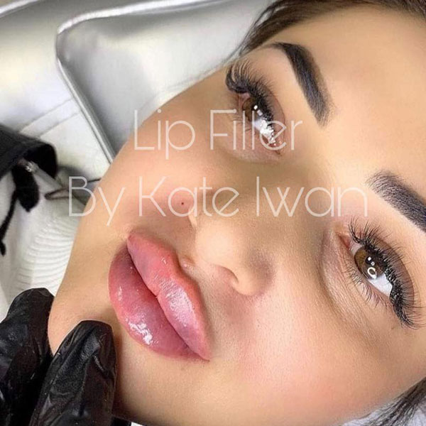Lip Filler 0.5ml