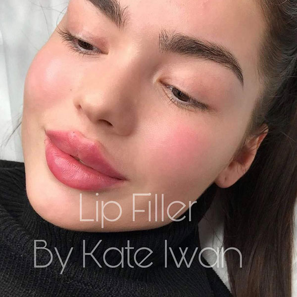 Lip Filler 1ml