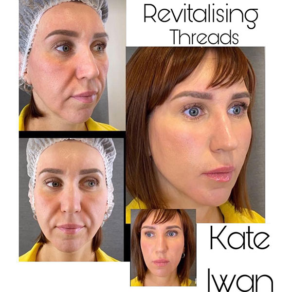 Revitalising Threads 10