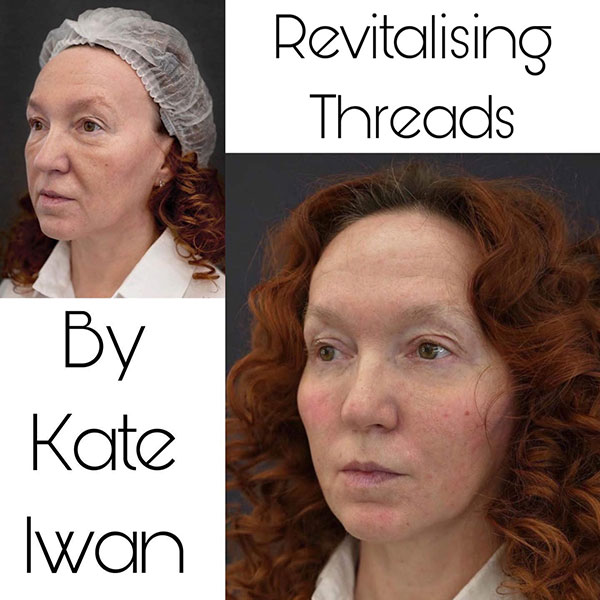 Revitalising Threads 20