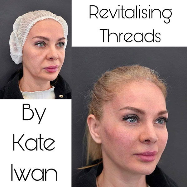 Revitalising Threads 30