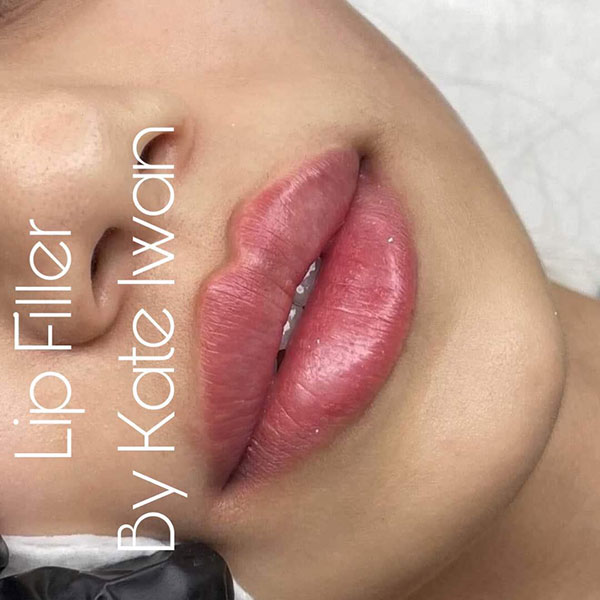 Botox (Forehead & Eyes) plus Lip Filler 0.5ml