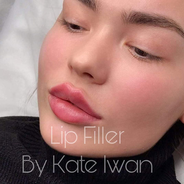 Botox (Forehead & Eyes) plus 1ml Filler Any Area