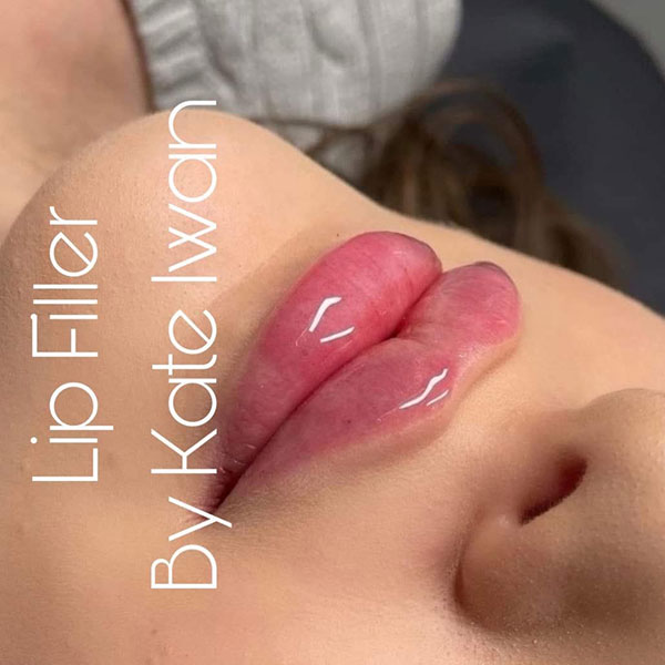 Botox (Forehead) plus Lip Filler 1ml